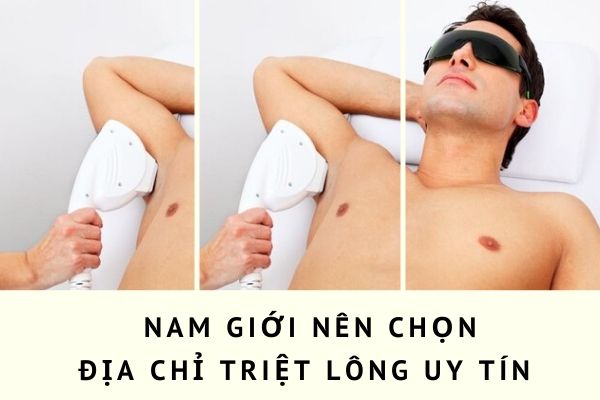 TRIỆT LÔNG NÁCH NAM - BH VĨNH VIỄN